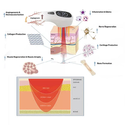 TheraBeam™ | Cold Laser Therapy Device for Knee Pain - KneePulse